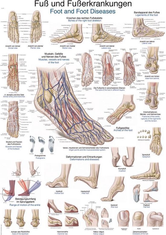 Het menselijk lichaam poster - Voet en voetaandoeningen poster (kunststof-folie, 70x100 cm)