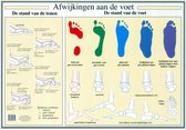 Anatomie poster voet en voetafwijkingen (Nederlands, gelamineerd, A2)