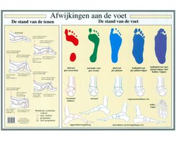Anatomie poster voet en voetafwijkingen (Nederlands, gelamineerd, A2)