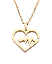 Hart heartbeat ketting | RVS | 316L | hartje | liefde | bff