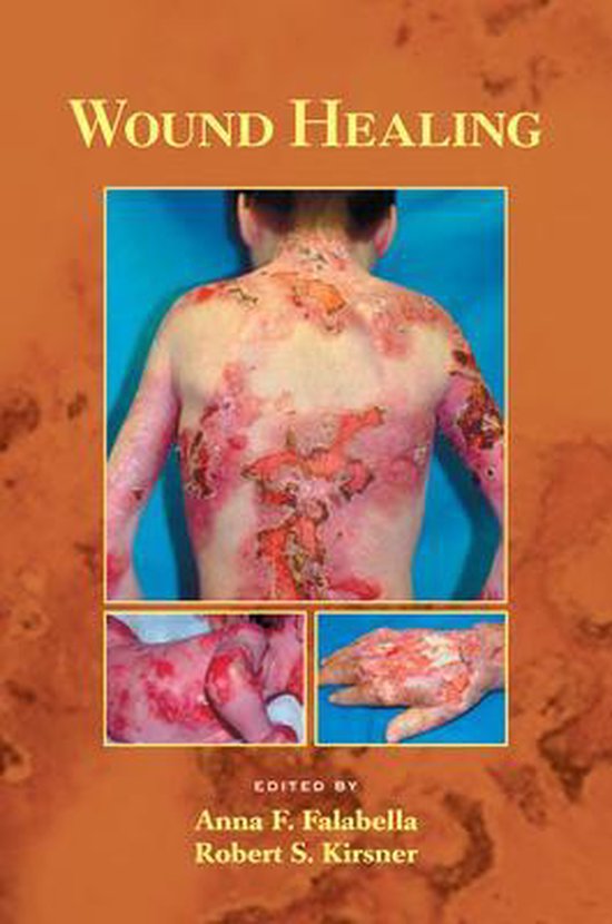 Wound Healing - cover