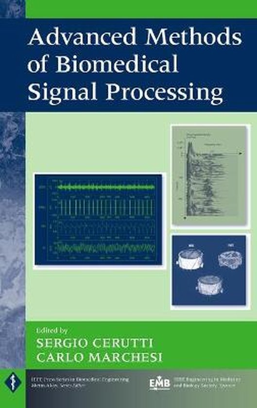 Advanced Methods of Biomedical Signal Processing 9780470422144 S