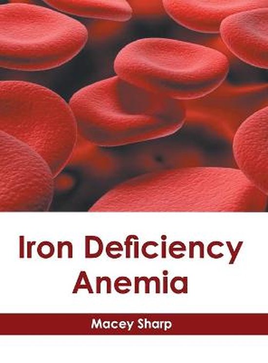 Iron Deficiency Anemia 9781639271832 MACEY SHARP Boeken