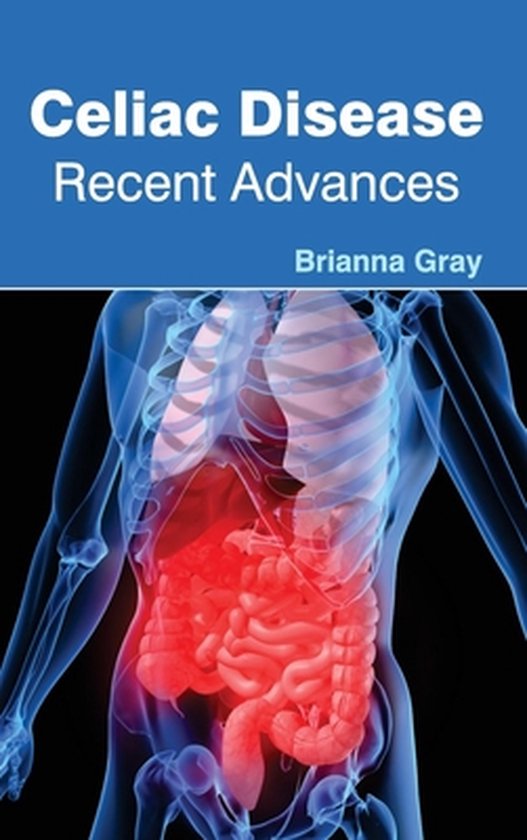 Celiac Disease: Recent Advances - cover