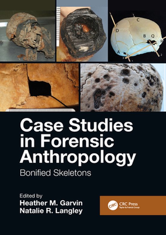 Case Studies in Forensic Anthropology (ebook) 9780429792595 Boeken