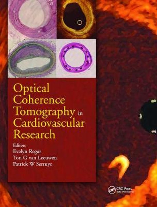 Optical Coherence Tomography in Cardiovascular Research 9781841846118