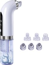 Lupio ​​Puistje verwijderen Black Dot elektrische gezichtsreiniging | stomer | facial steamer | gezichtsstomer | face steamer | facial cleanser | facial sauna