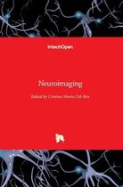 Neuroimaging