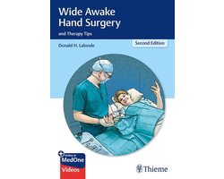 健康・医学 Wide Awake Hand Surgery and Therapy Tips Wide Awake Hand Surgery and Therapy Tips | 9781684202300