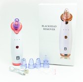 Blackhead remover - Blackhead remover vacuum - porienreinigers - Puisten verwijderaar - Mee eter verwijderaar  - Vacuüm cleaner