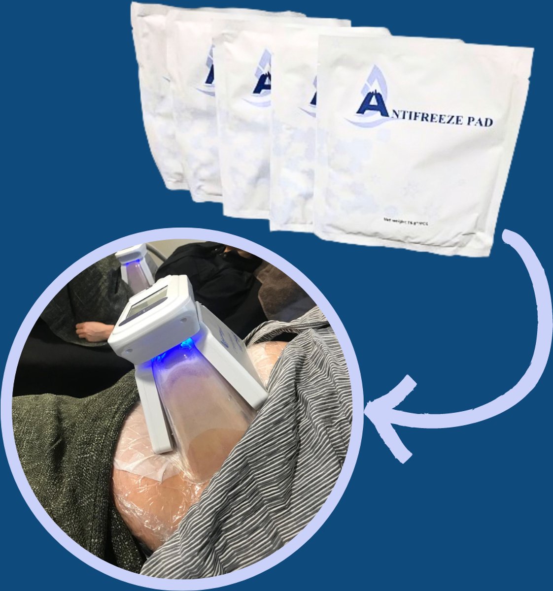 Goedkoopste Anti Freeze Membrane - 10 stuks - Maat L - 30×45 cm - Membrane Voor Een Cryolipolyse Behandeling - Cryolipolyse pads - Cryopad