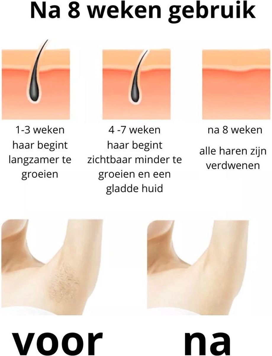 Laser Ontharingsapparaat - IPL Ontharing Apparaat - Epileerapparaat Dames - Inclusief Beschermbril, Scheermes - Roze thumbnail 8