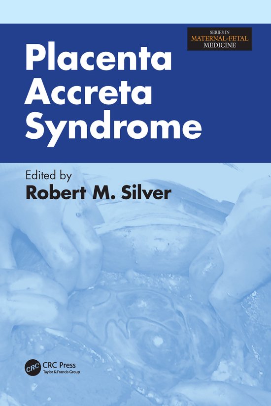 Foto: Series in maternal fetal medicine placenta accreta syndrome