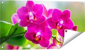 Gards Tuinposter Roze Orchidee Bloemen - 80x40 cm - Tuindoek - Tuindecoratie - Wanddecoratie buiten - Tuinschilderij