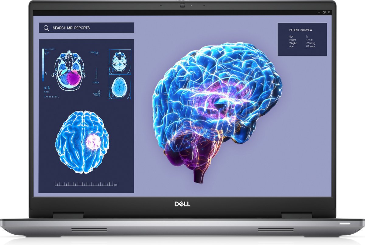 DELL Precision 7680 - CH0R1