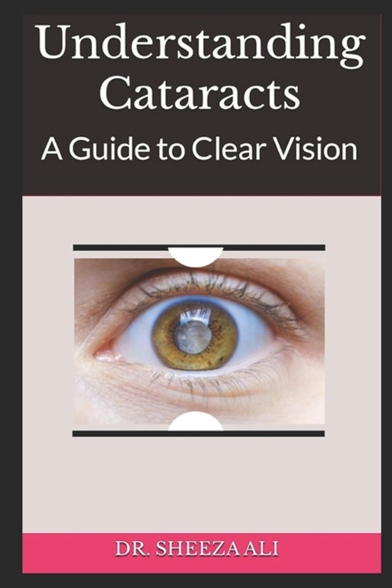 Understanding Cataracts - cover