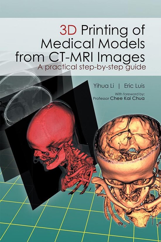 3D Printing of Medical Models from Ct-Mri Images - cover