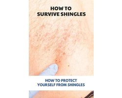 How To Survive Shingles
