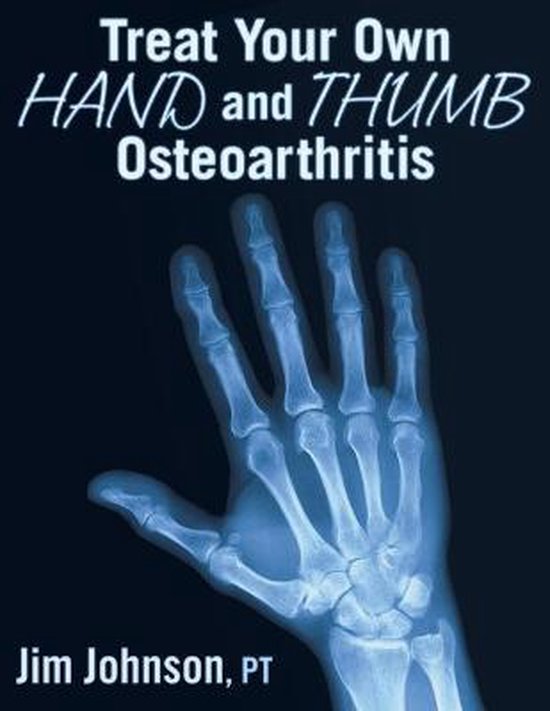 Treat Your Own Hand and Thumb Osteoarthritis - cover