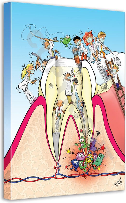 Tandarts Cartoon op canvas - Roland Hols - Doorsnede kies - 90 x 60 cm - Houten frame 4 cm dik - Orthodontist - Mondhygiënist