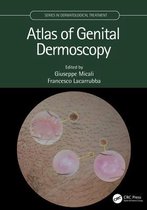 Series in Dermatological Treatment - Atlas of Genital Dermoscopy