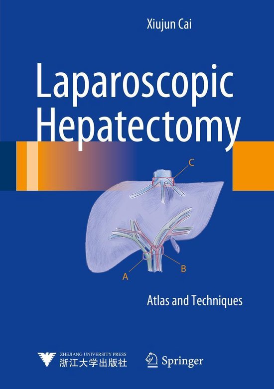 Medicine (R0) - Laparoscopic Hepatectomy - cover