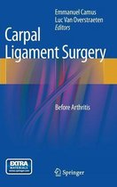 Carpal Ligament Surgery