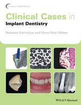 Clinical Cases (Dentistry) - Clinical Cases in Implant Dentistry