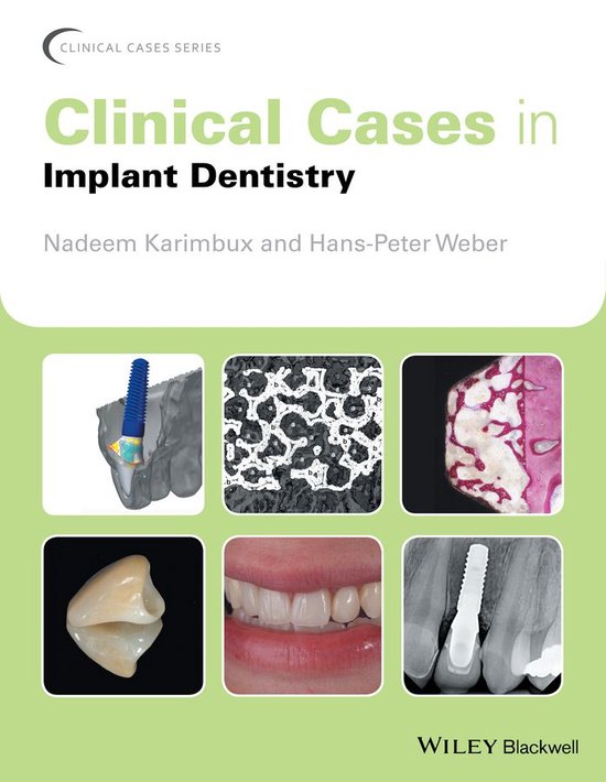 Clinical Cases (Dentistry) Clinical Cases in Implant Dentistry (ebook