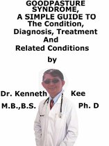 Goodpasture Syndrome, A Simple Guide To The Condition, Diagnosis, Treatment And Related Conditions