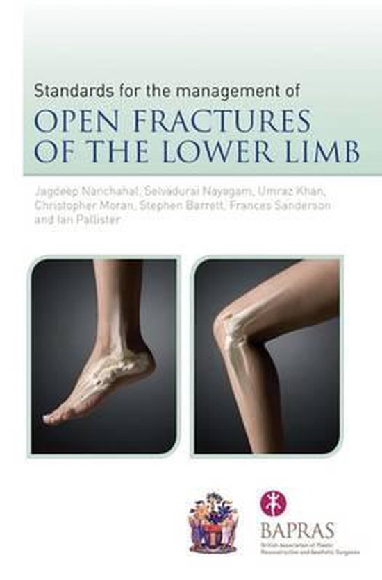 The Standards for the Management of Open Fractures of the Lo ... - cover