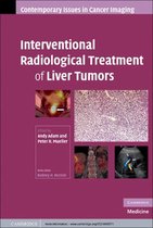Contemporary Issues in Cancer Imaging -  Interventional Radiological Treatment of Liver Tumors