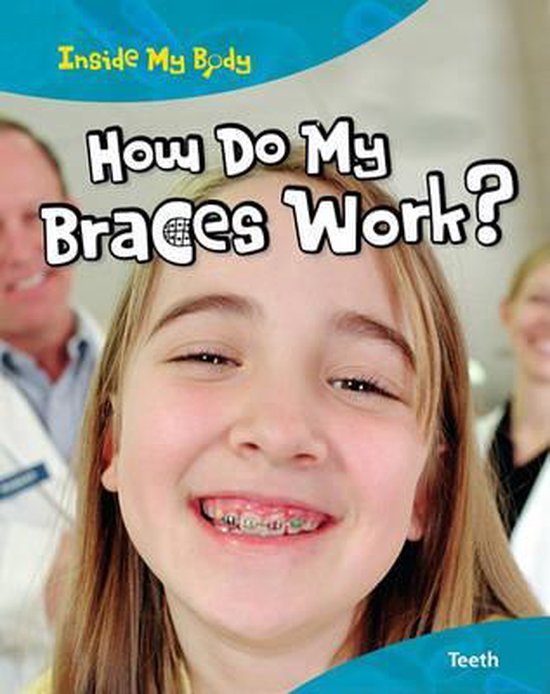 How Do My Braces Work?, Steve Parker 9781410940193 Boeken