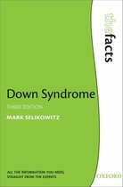 The Facts - Down Syndrome
