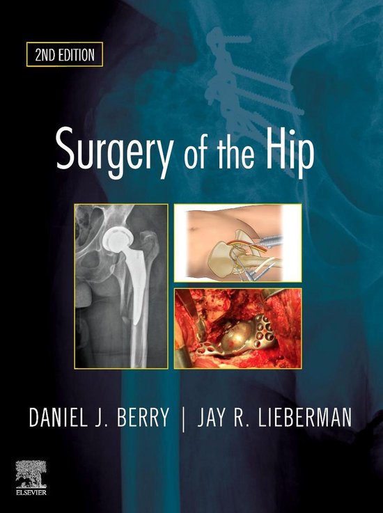 Surgery of the Hip E-Book - cover