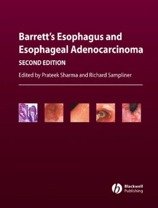 Barrett's Esophagus and Esophageal Adenocarcinoma 9781405127868