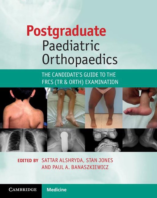 Postgraduate Paediatric Orthopaedics - cover