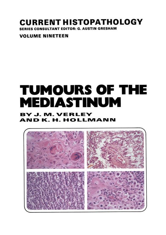 Medicine (R0) - Tumours of the Mediastinum - cover