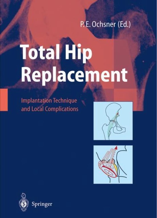 Total Hip Replacement - cover