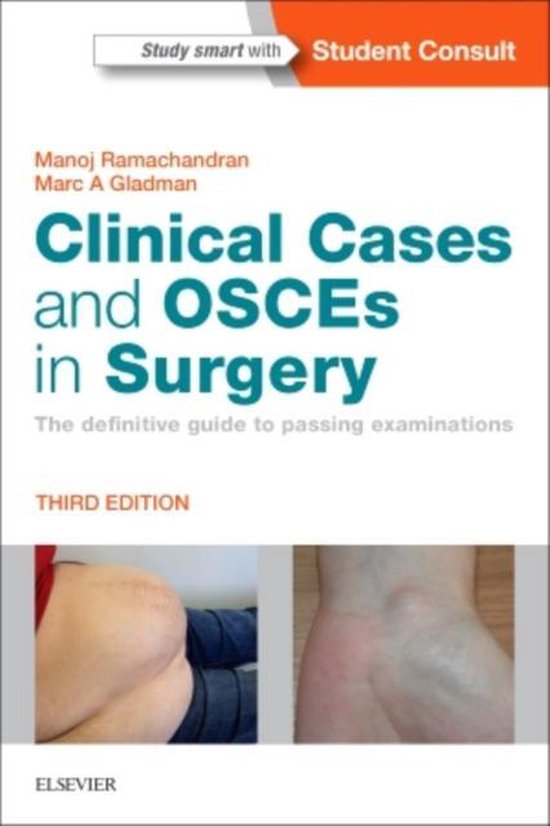 Clinical Cases and OSCEs in Surgery - cover