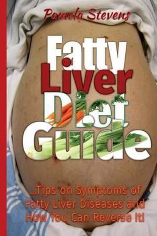 Fatty Liver Diet Guide, Pamela Stevens 9781533129093 Boeken