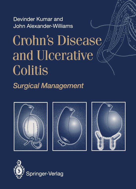 Medicine (R0) - Crohn’s Disease and Ulcerative Colitis - cover