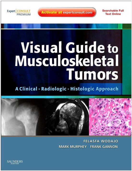 Visual Guide To Musculoskeletal Tumors A Clinical Radiologic