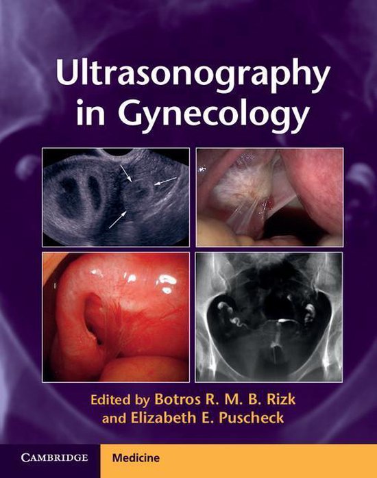 Ultrasonography in Gynecology - cover