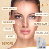 Heritage Acne black masker - Antibacterieel - salicyl acid - tegen puist - tegen acnevlekken - tegen vette huid - tegen ontstekingen