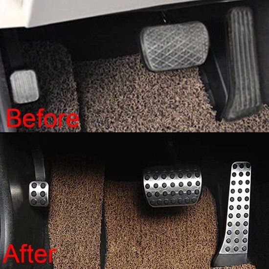 Juwaacoo Edelstahl Pedale Set - 4-teilig Für Mercedes C & E Klasse Automatik