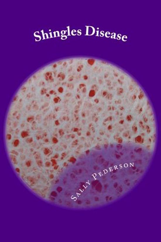 Shingles Disease: The Complete Guide - cover