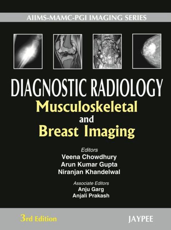 Diagnostic Radiology 9789350258835 Veena Chowdhury Boeken