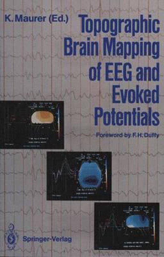 Topographic Brain Mapping of EEG and Evoked Potentials 9783540178026