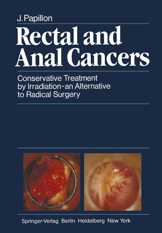 Medicine (R0) - Rectal and Anal Cancers - cover